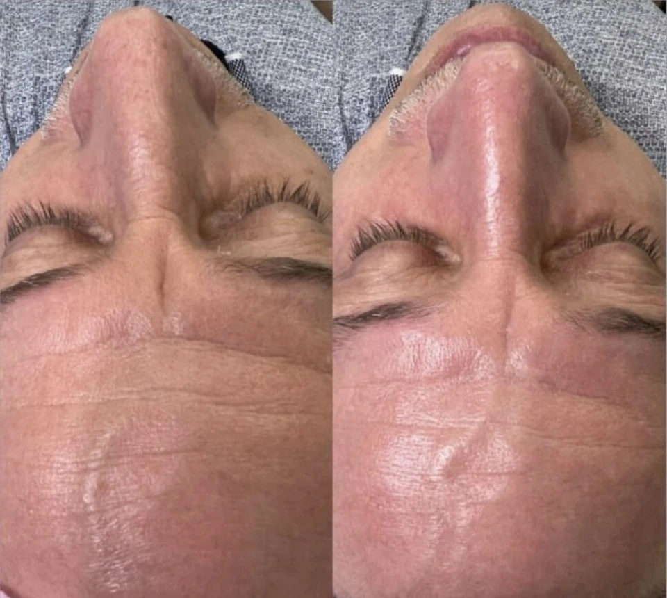 Салон красоты Клиника косметологии Pro Skin на улице Маяковского - 2