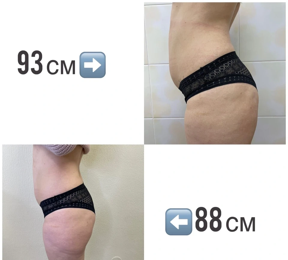 Салон красоты криолиполиза и хис CRIO_ZONE - 4